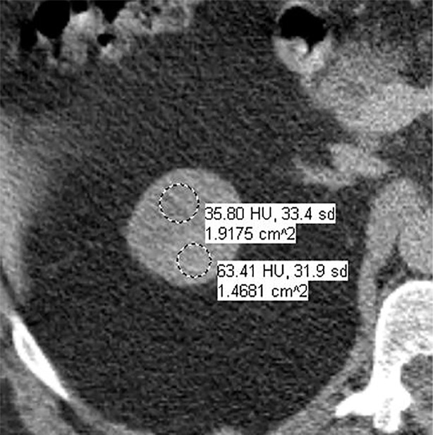 Figure 5b: