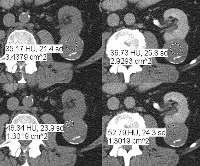 Figure 6a: