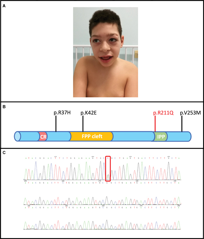 Fig. 1