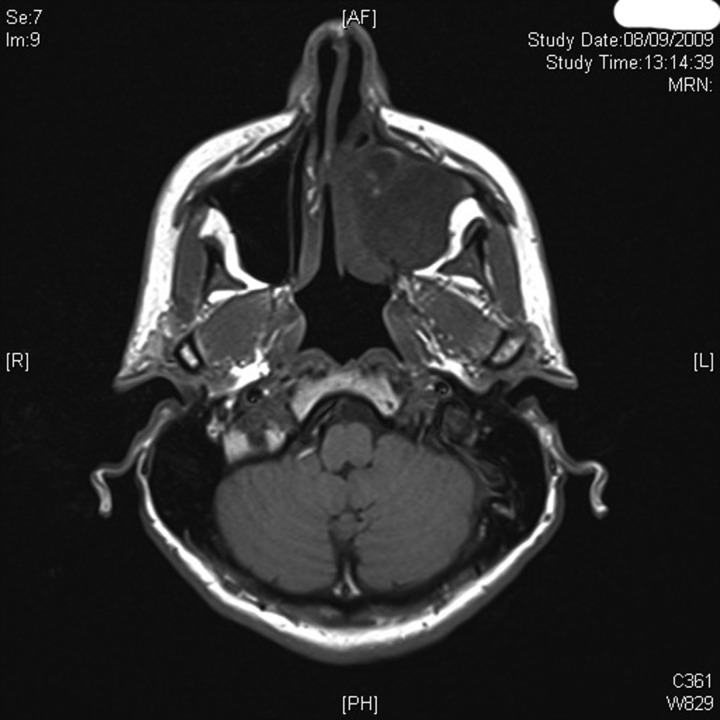 Figure 2