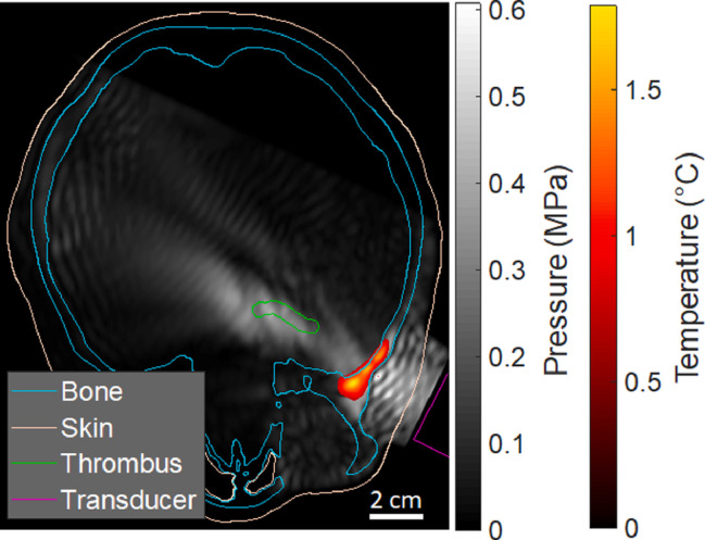 Fig 6