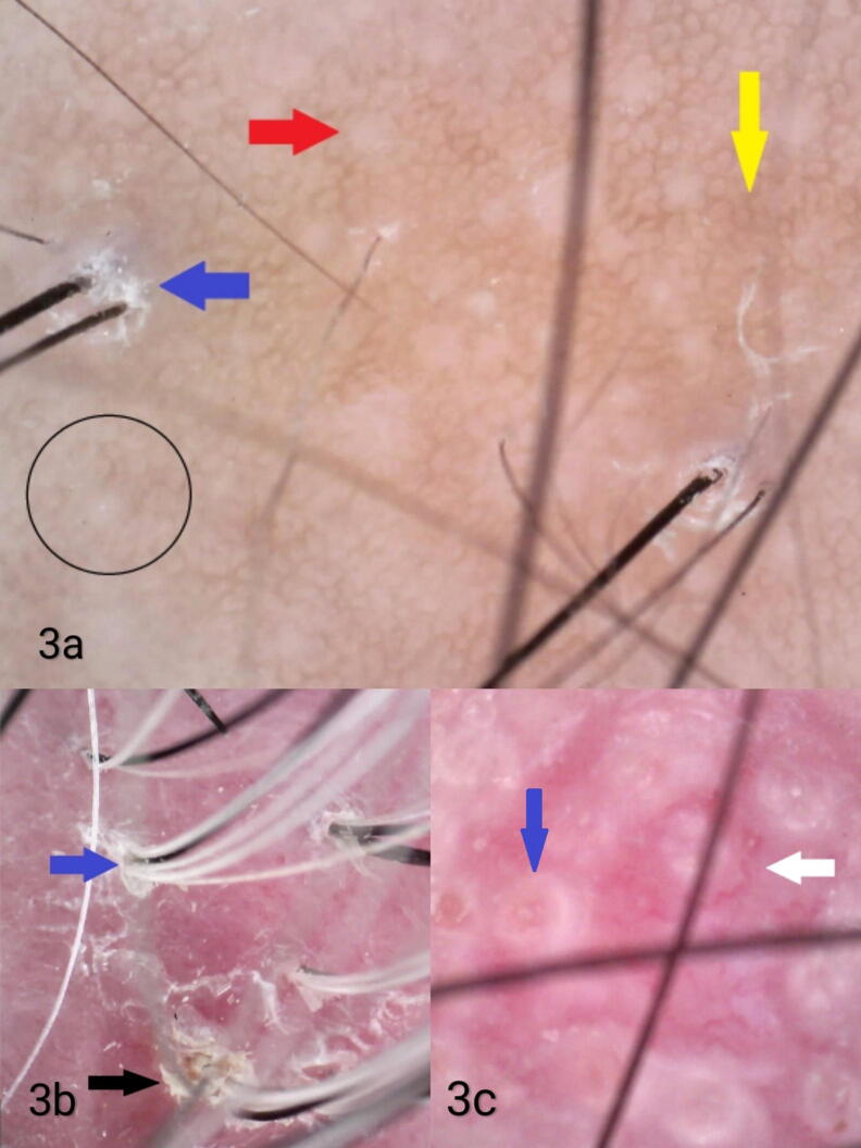 Fig. 3