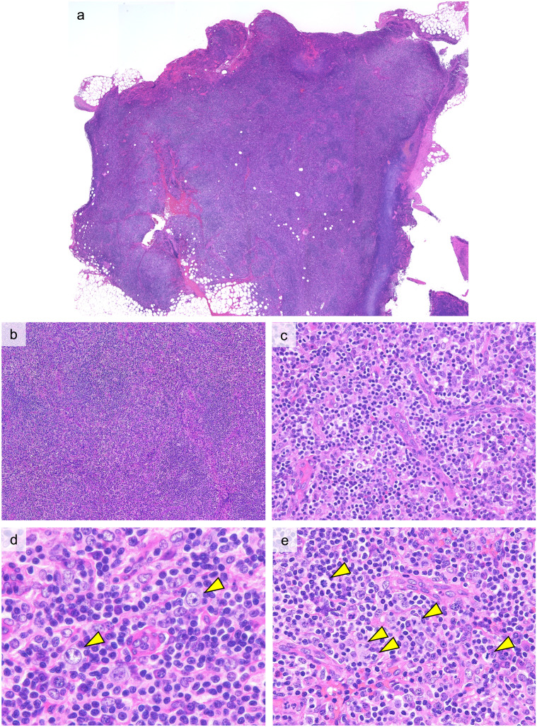 Fig. 2