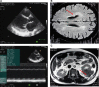 Fig. 2