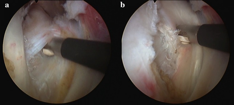 Fig. 4