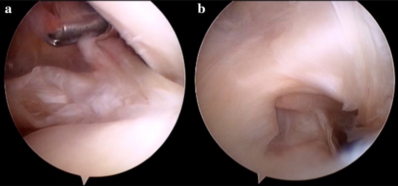 Fig. 3