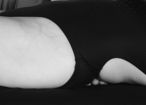 Fig. 3
