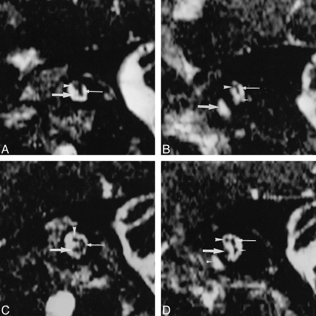 FIG 1.