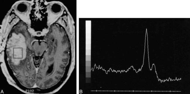 fig 4.