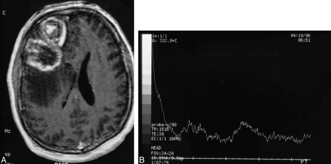 fig 3.