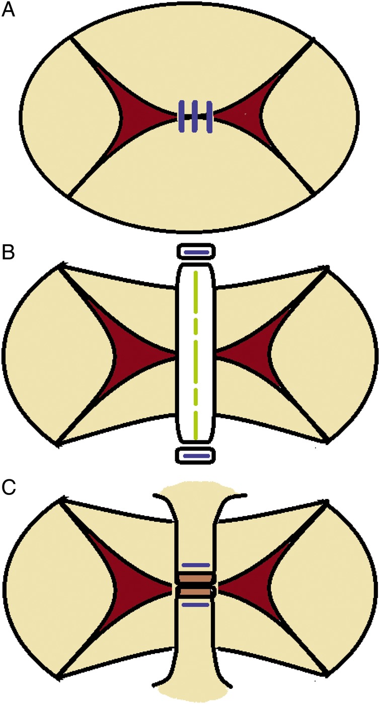 Figure 2: