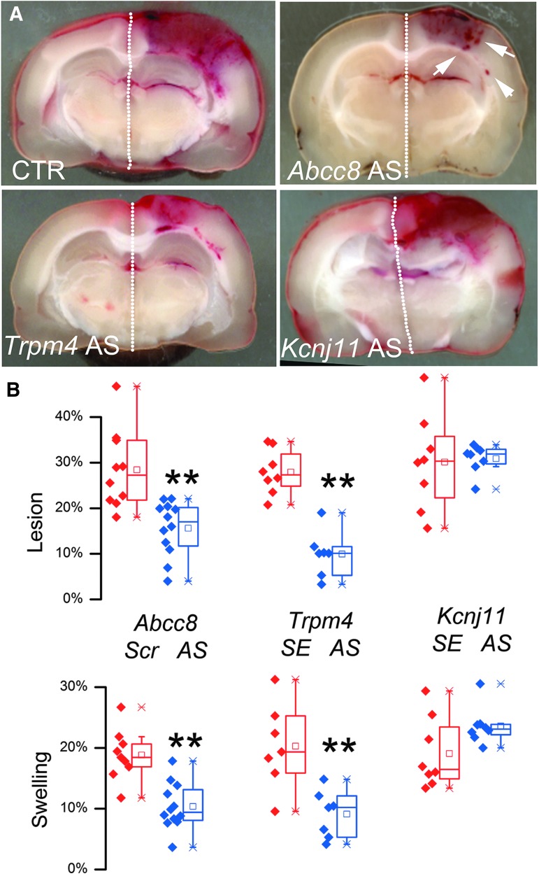 FIG. 11.