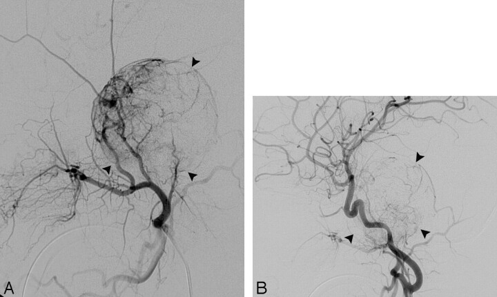 Fig 3.