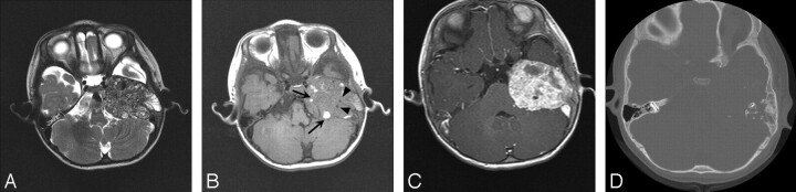 Fig 2.