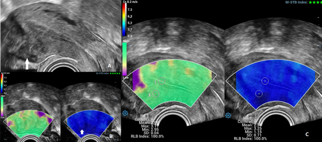 Fig. 4