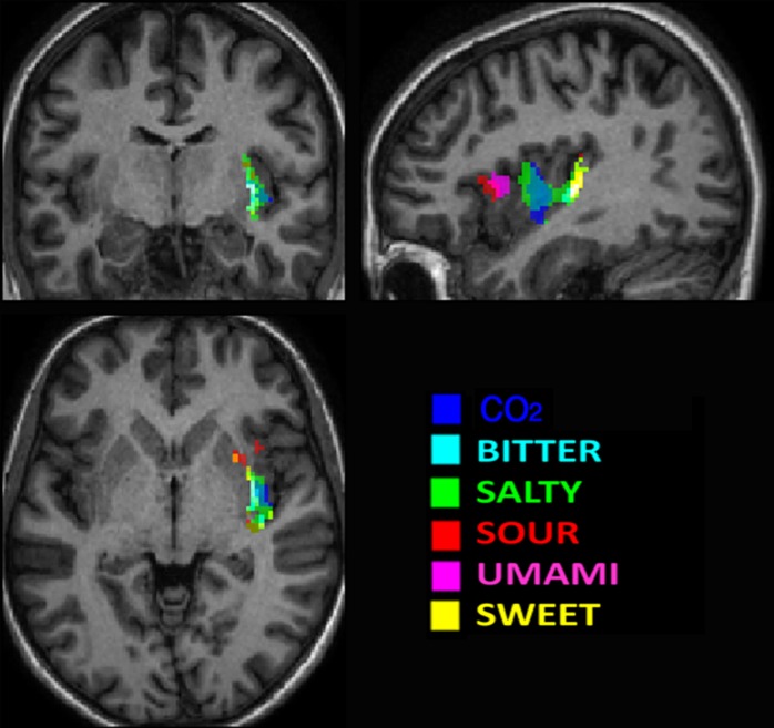 Fig 3