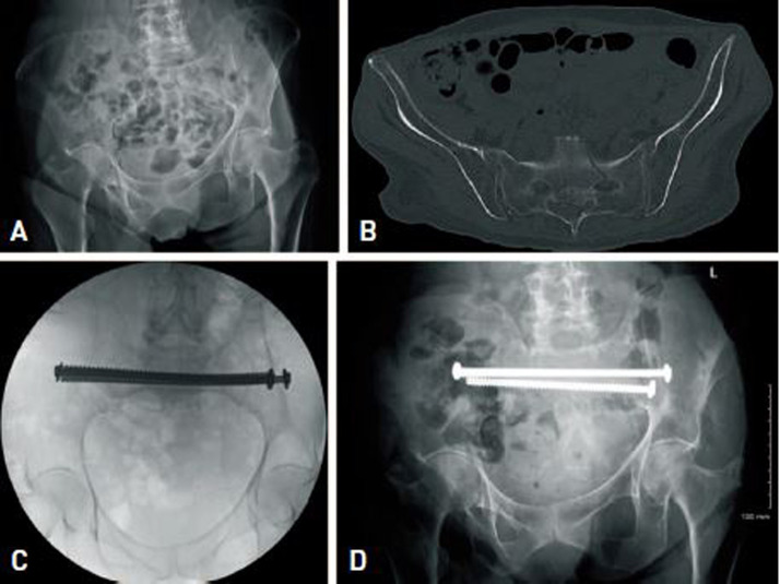 Fig. 2