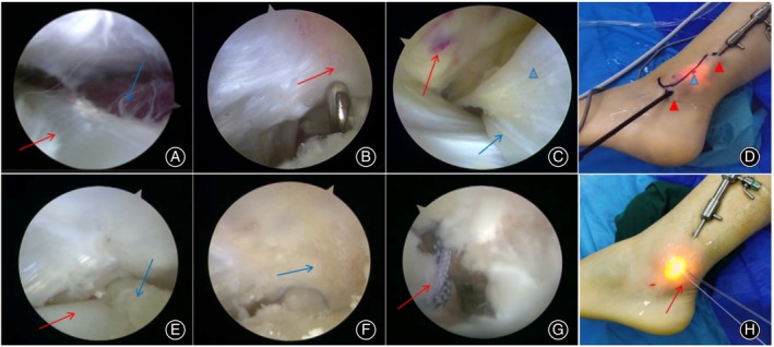 FIGURE 4