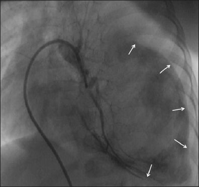 Figure 3b