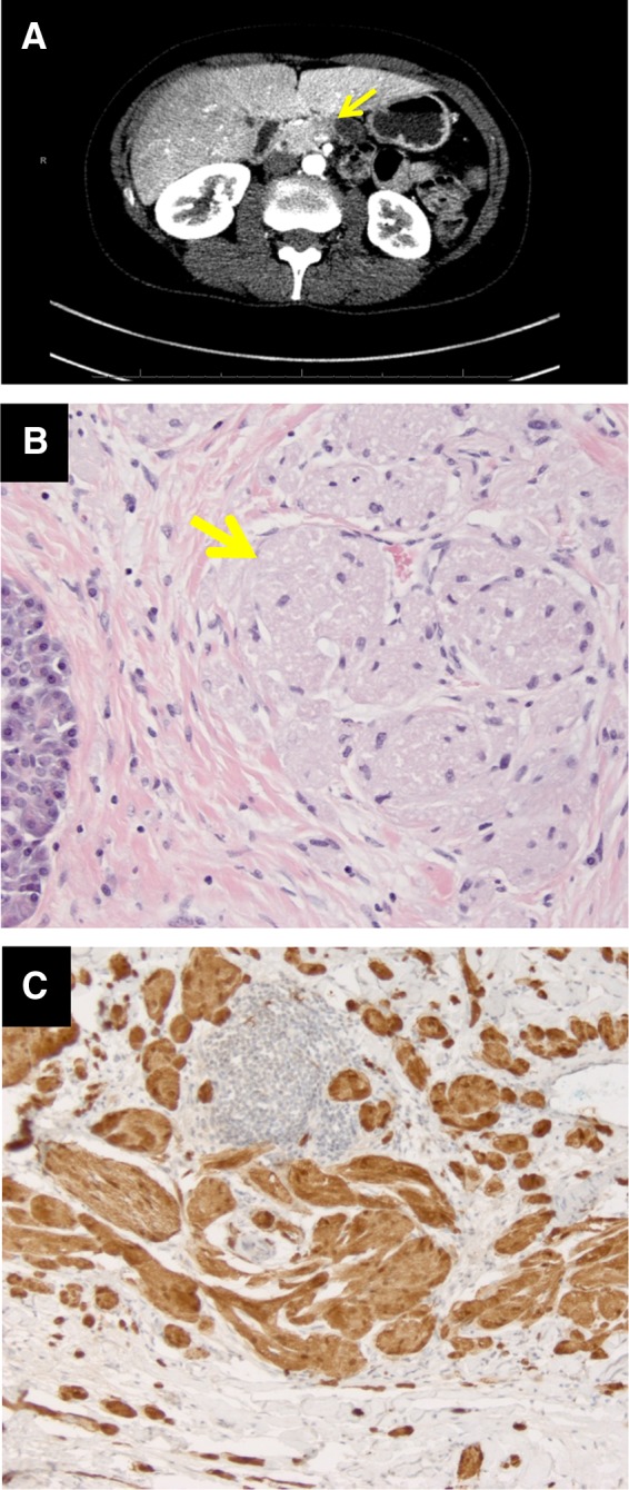 FIG. 1.