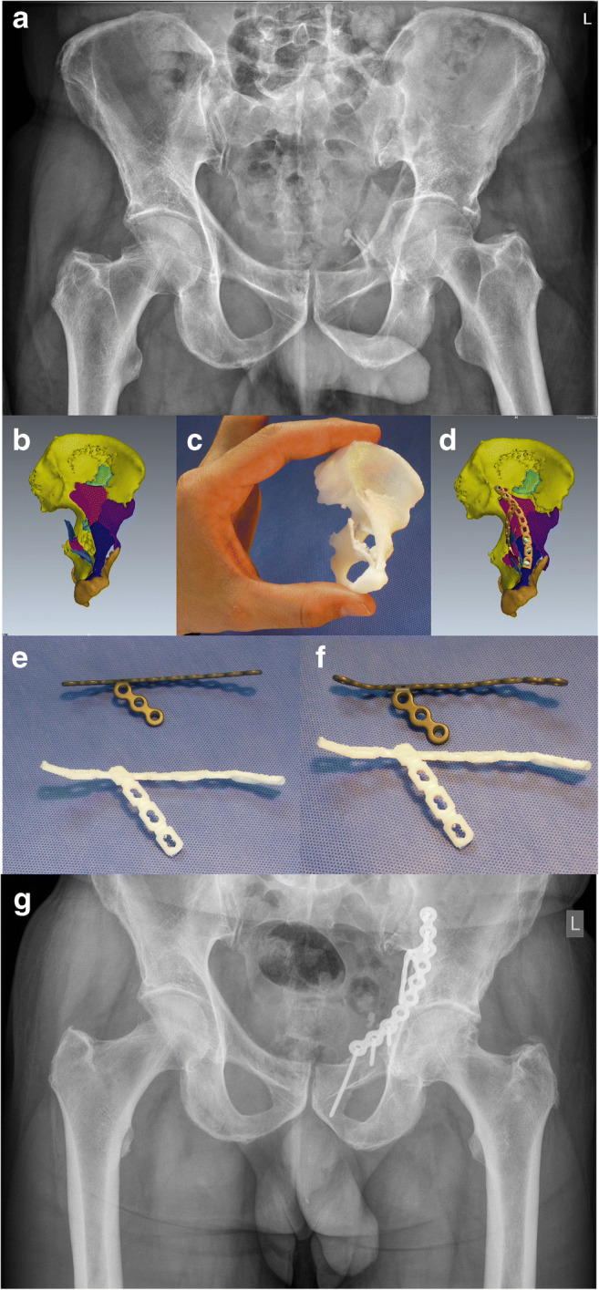 Fig. 1