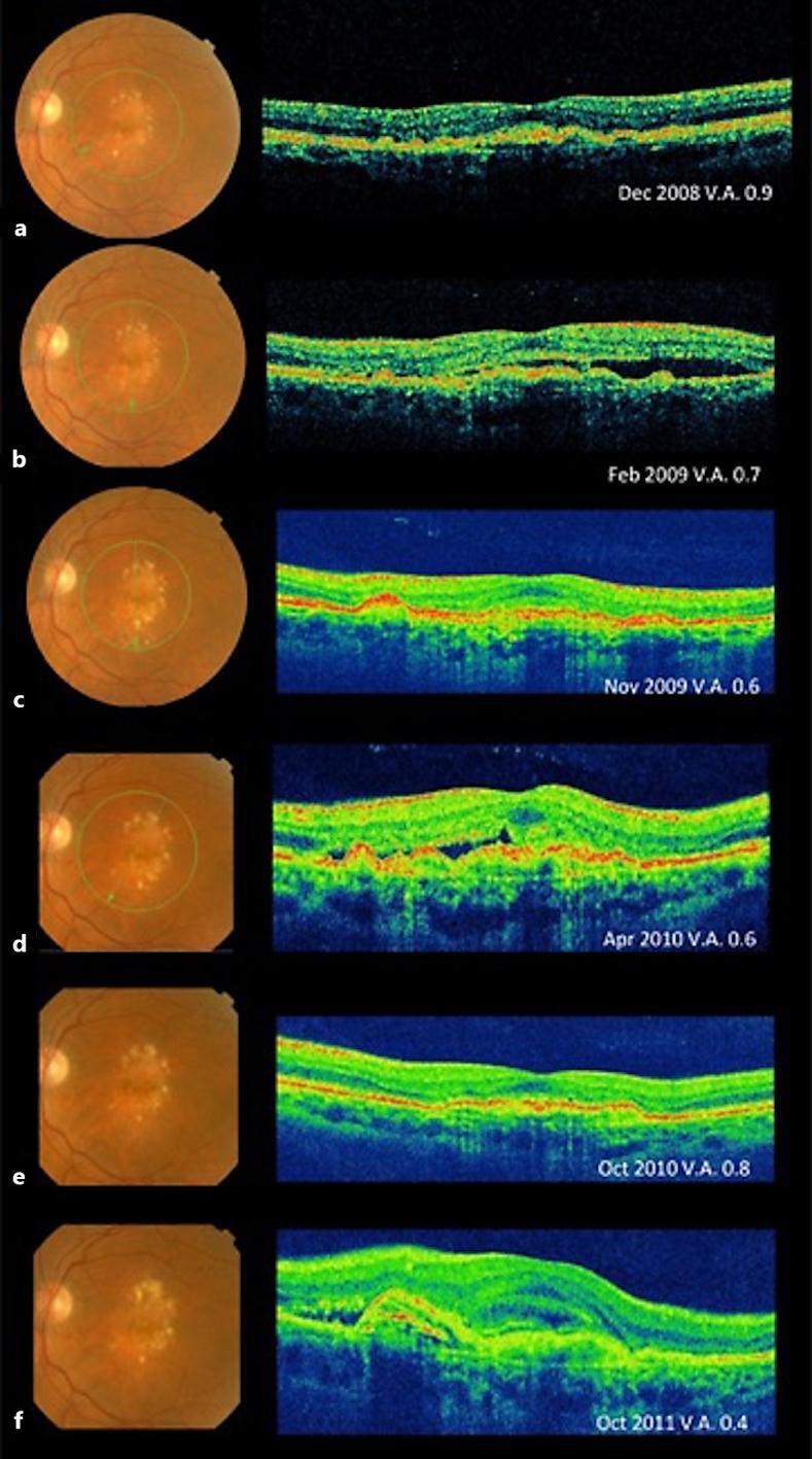 Fig. 2