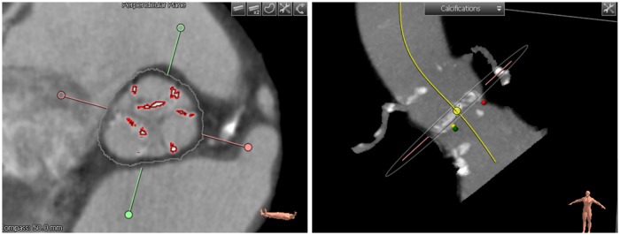 Fig 3