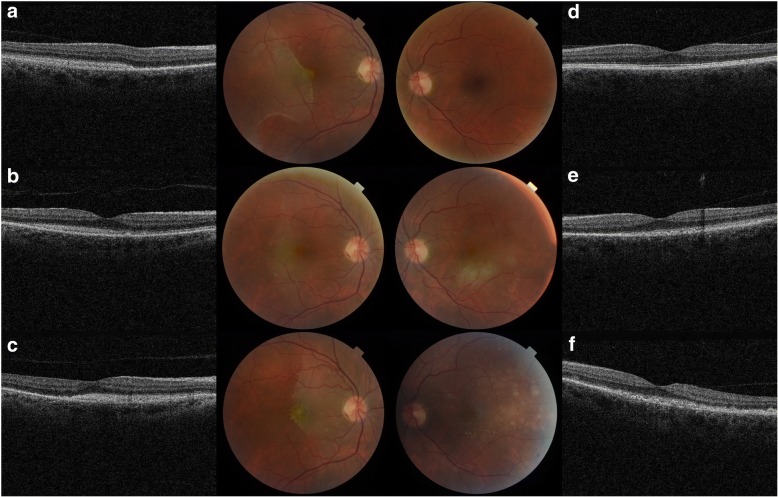 Fig. 1