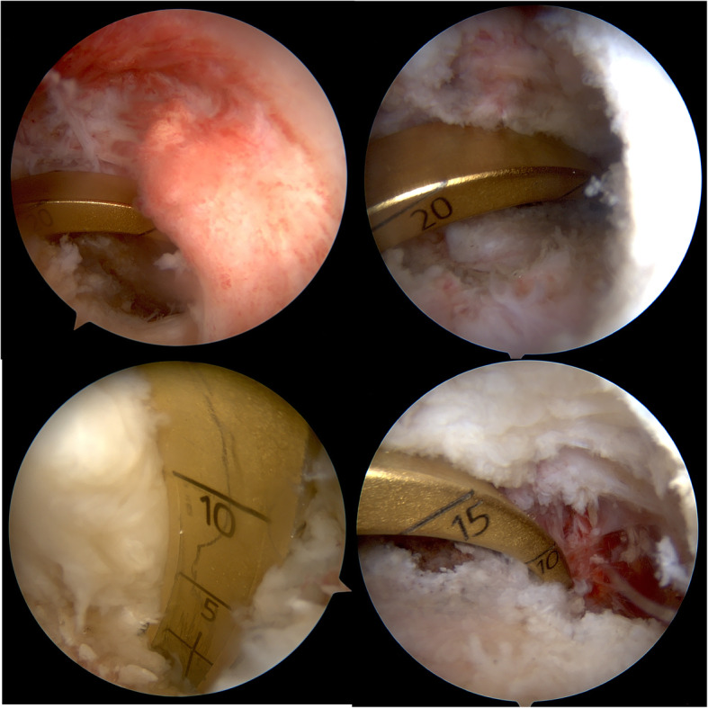 Fig. 2