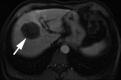Figure 7b: