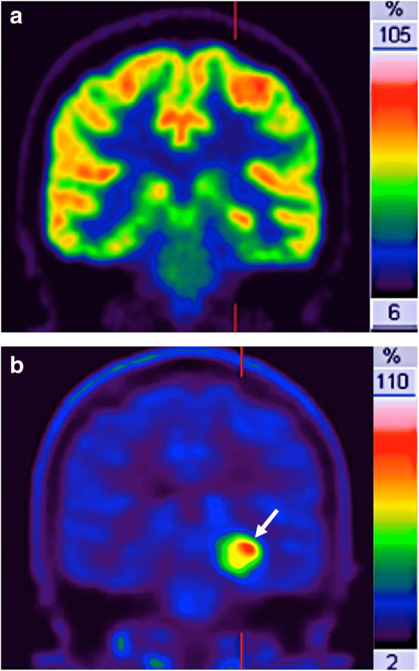 Fig. 15