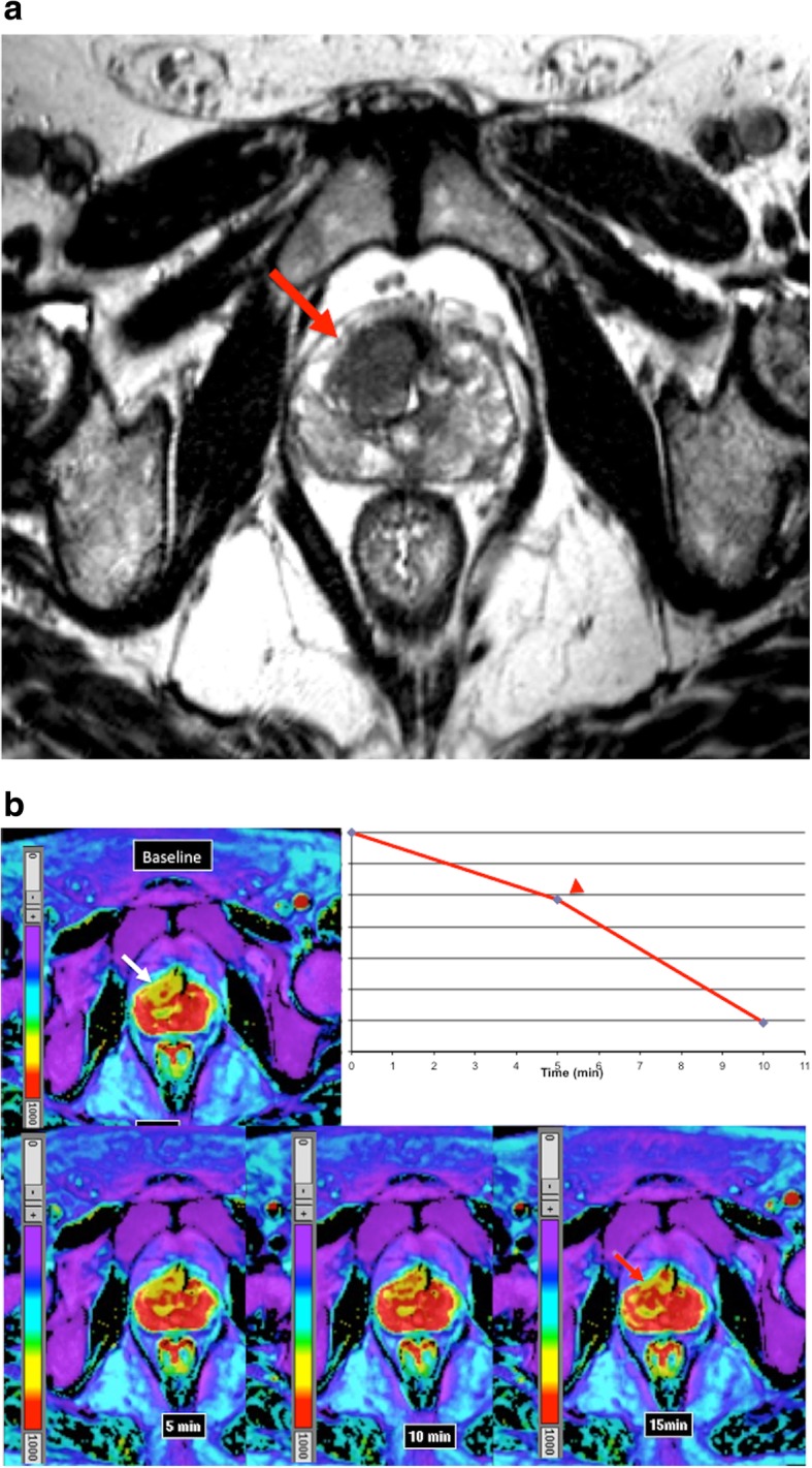 Fig. 10