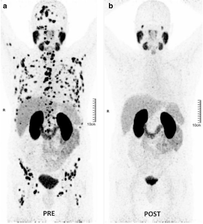 Fig. 11