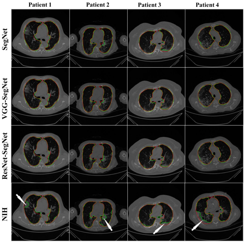 Figure 12