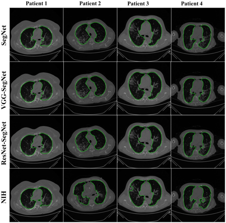 Figure 11