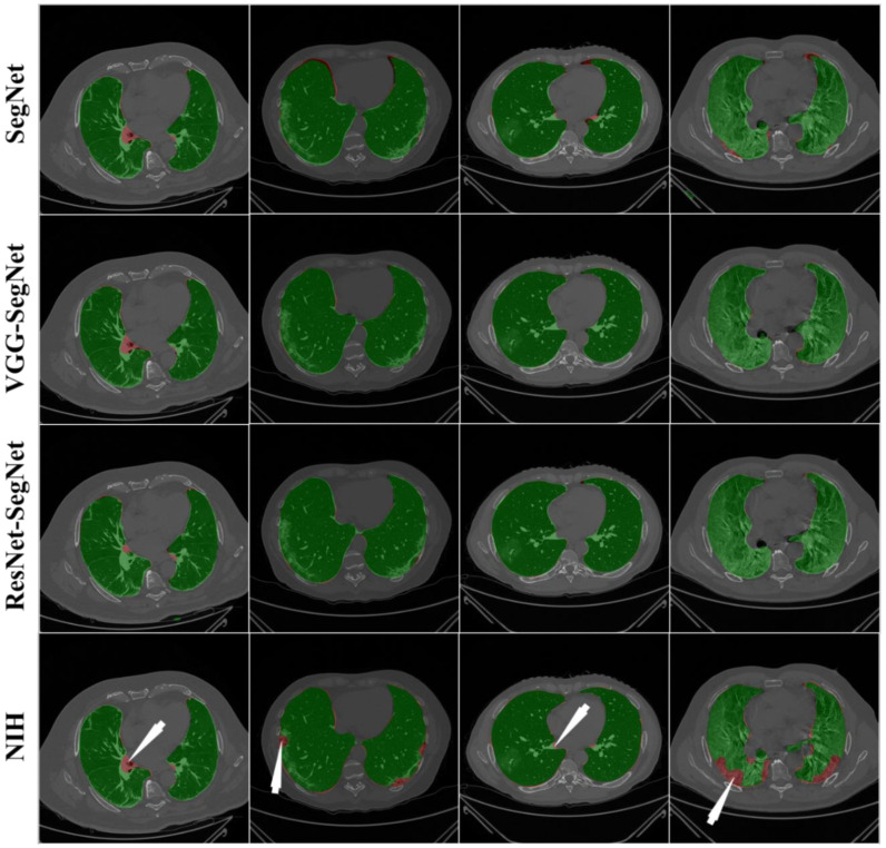 Figure 13