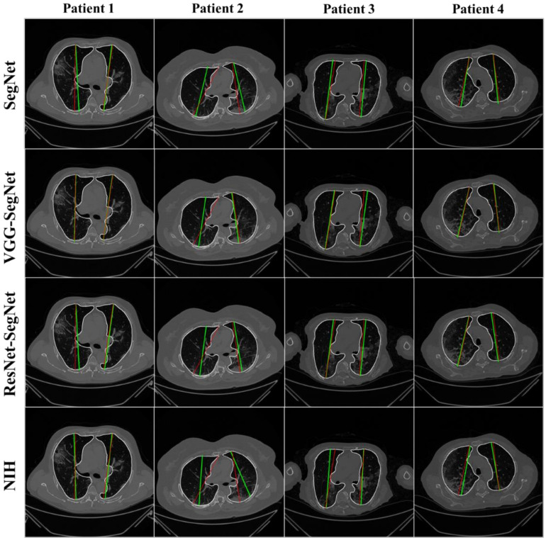 Figure 15