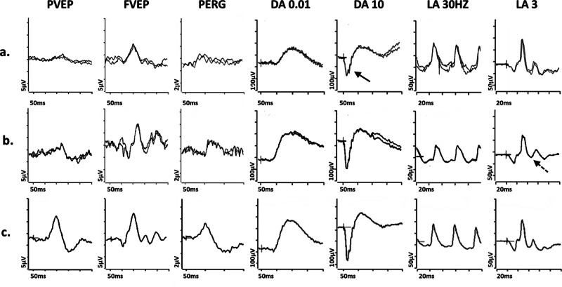 Fig. 3