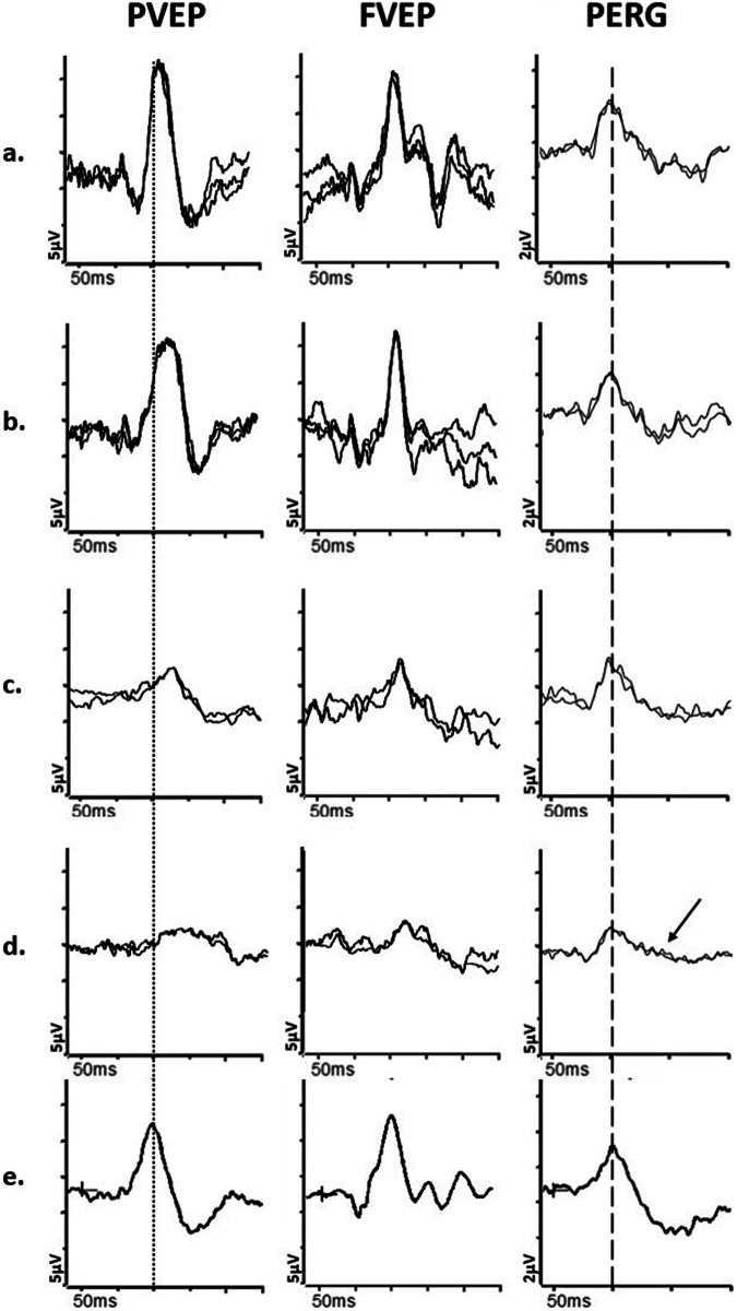 Fig. 4