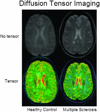 FIG. 11.