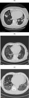 Fig. (2)