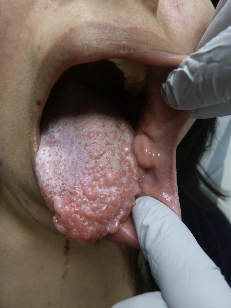 Fig 3