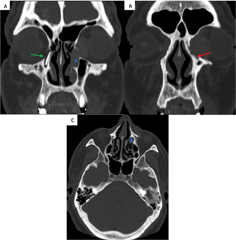 Fig 2