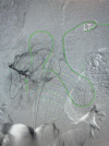 Figure 9