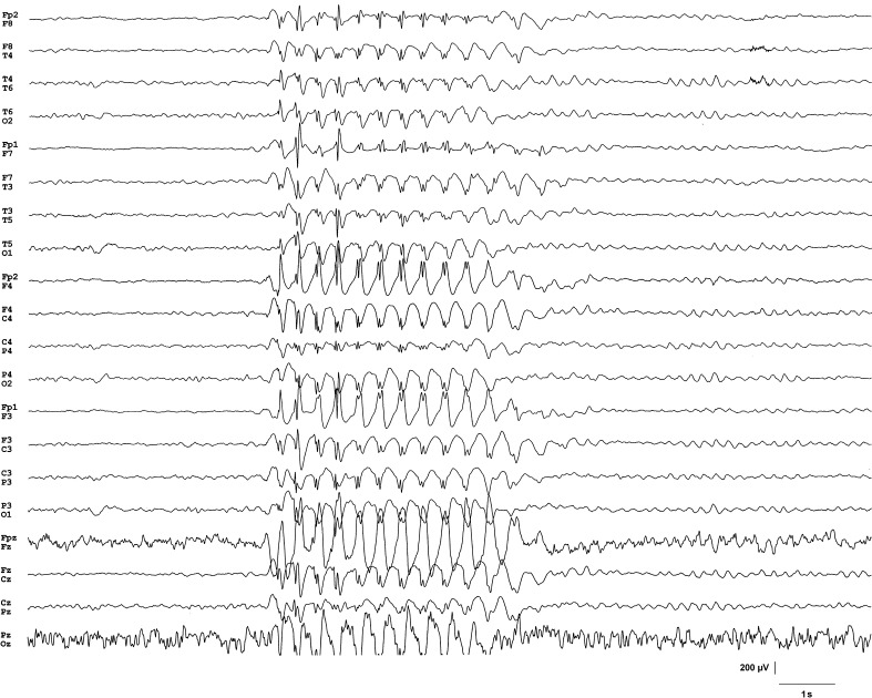 Fig. 1