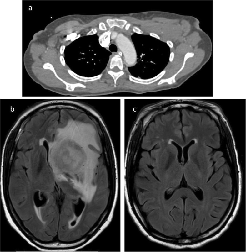 Fig. 10