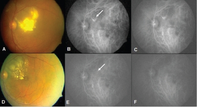 Figure 4