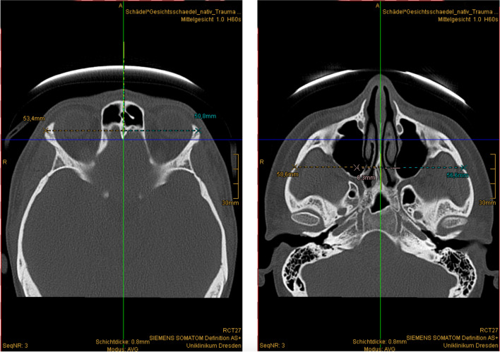 Fig. 2