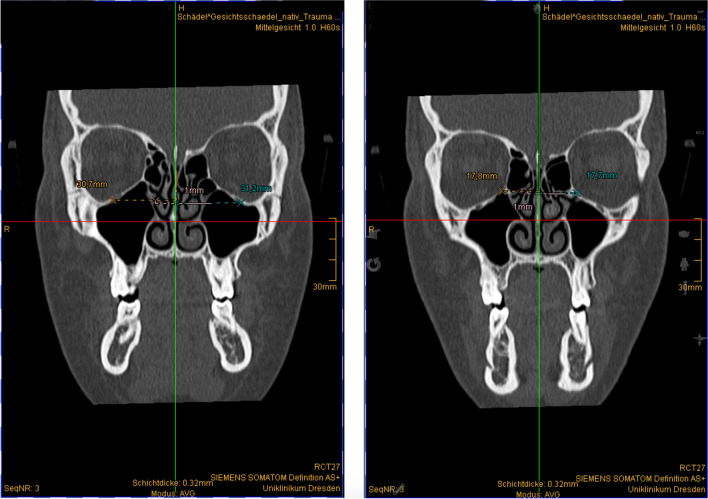 Fig. 3