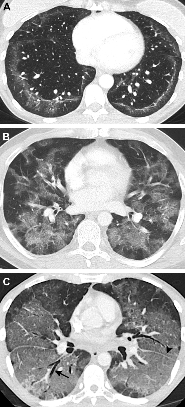 Figure 4